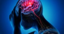 Acidente Vascular Cerebral: entenda quais são os sintomas, diagnóstico e prevenção