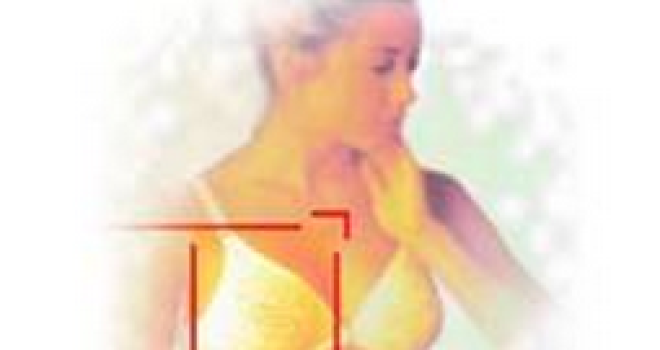 CÂNCER DE MAMA – PREVENÇÃO E DETECÇÃO PRECOCE CÂNCER DE MAMA – PREVENÇÃO E DETECÇÃO PRECOCE