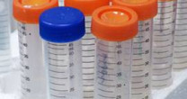 CÂNCER: PREVENÇÃO E DETECÇÃO PRECOCE CÂNCER: PREVENÇÃO E DETECÇÃO PRECOCE