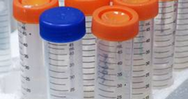 CÂNCER: PREVENÇÃO E DETECÇÃO PRECOCE CÂNCER: PREVENÇÃO E DETECÇÃO PRECOCE