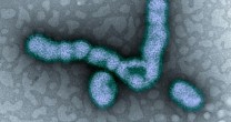 QUAL É A DIFERENÇA DA GRIPE COMUM PARA A H1N1? – POR LÍRIA JADE E FERNANDA DUARTE
