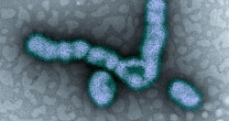 QUAL É A DIFERENÇA DA GRIPE COMUM PARA A H1N1? – POR LÍRIA JADE E FERNANDA DUARTE QUAL É A DIFERENÇA DA GRIPE COMUM PARA A H1N1? – POR LÍRIA JADE E FERNANDA DUARTE